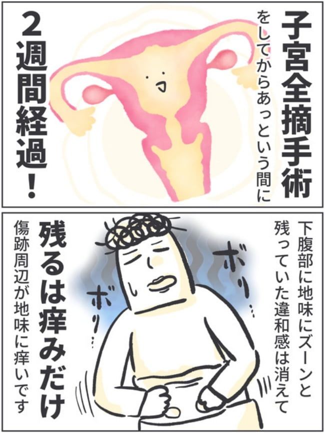 子宮全摘記録10