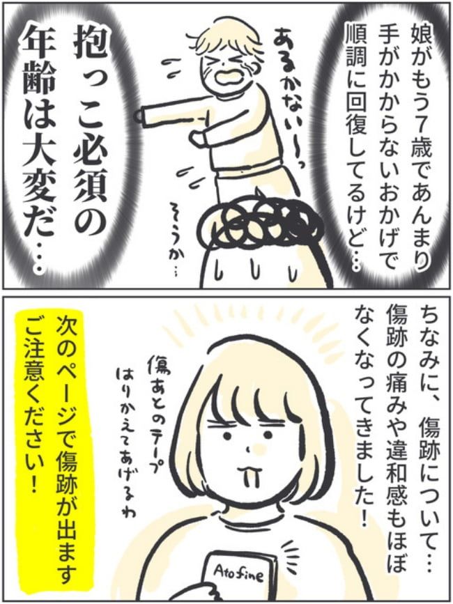 子宮全摘記録10