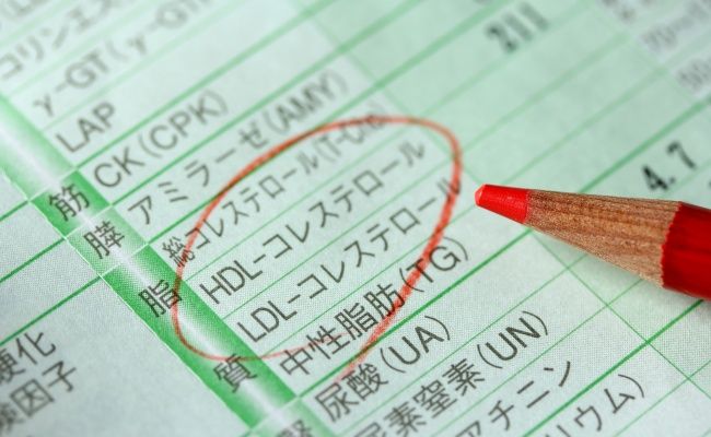 コレステロール