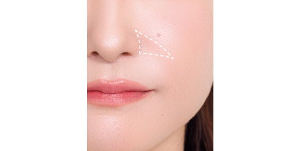 三角形に小鼻横の影をカバーする