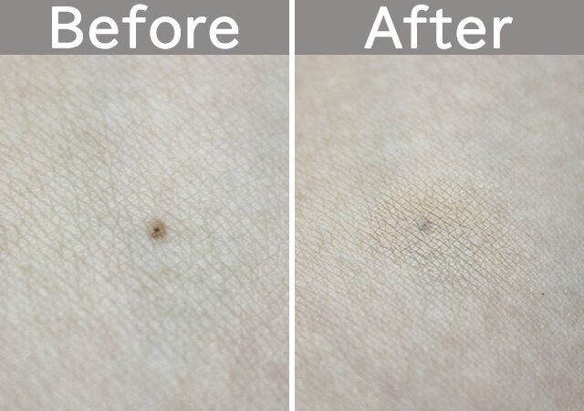 セリアのスティックパフ キノコ型 小 Before After