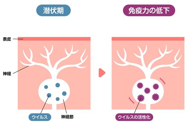 潜伏ウイルス イメージ