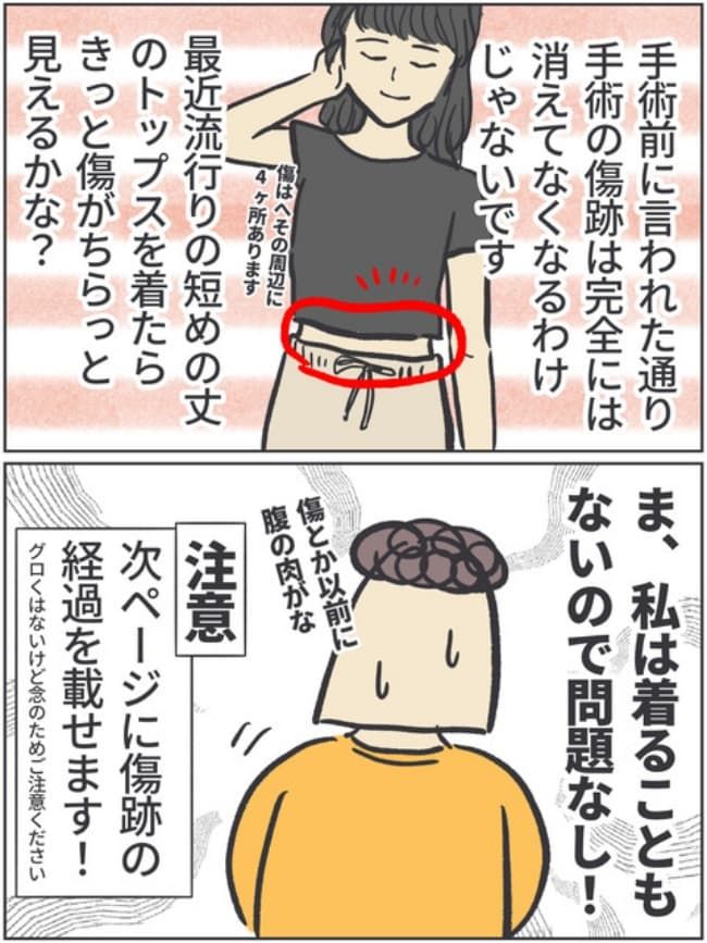 子宮全摘記録14