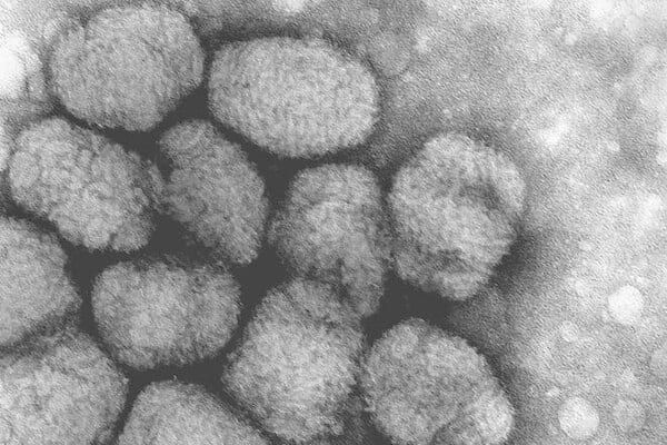 天然痘ウイルス、奈良時代の人々にとって天然痘はまさに災厄であった