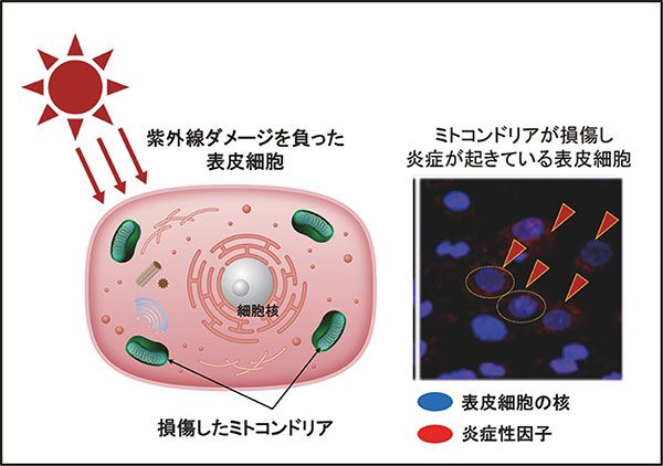 ミトコンドリアが損傷すると炎症状態に！