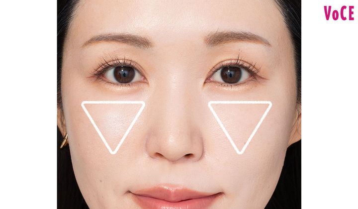 ３：頬の中心にボリュームを注入してバブみアップ！