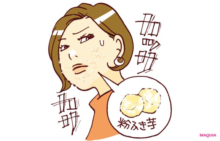  どうして潤わない？ 砂漠肌状態の「なぜ」に貴子先生が回答。年齢別のお手入れ法も教えます_7