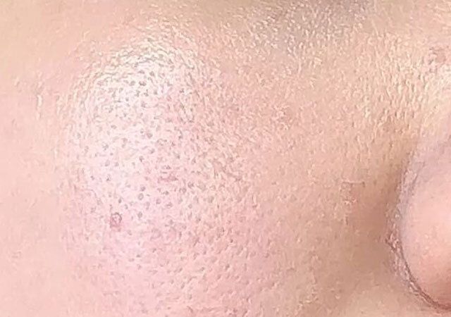 KMシルキーリキッドファンデーション 塗布後