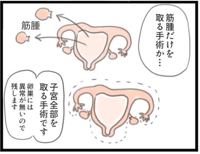 #子宮筋腫ができたのは私のせい？ 8