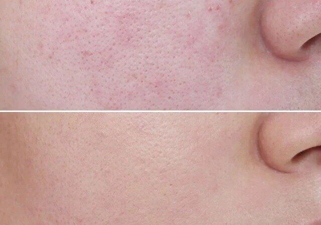 ダイソー ミニサイズ カバー 