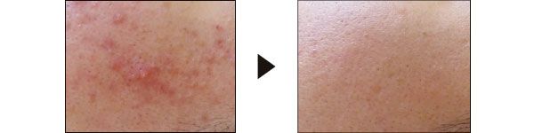 12回でこの変化！