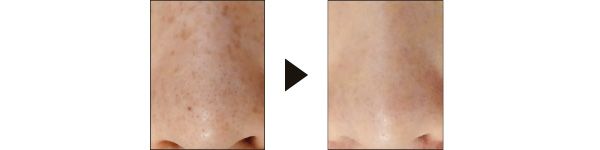 2回でこの変化！