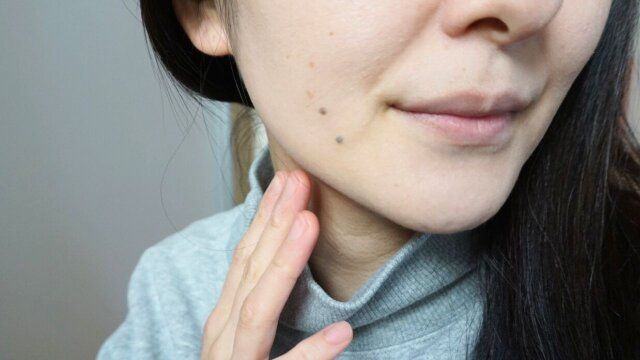 フェイスライン