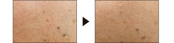 12回でこの変化！