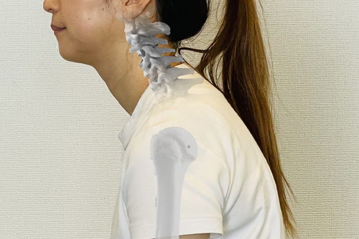 ストレートネック、放置すると……