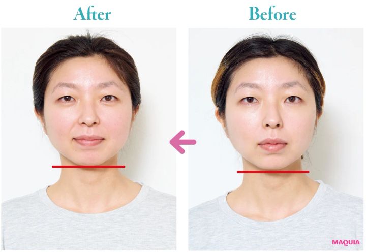 話題の“小顔師”吉田圭吾さんの施術でここまで小顔に！ Before→After写真付きで報告_18