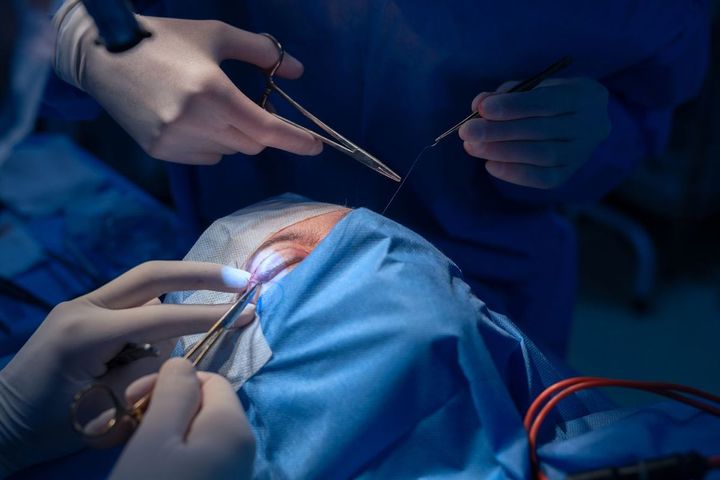 二重まぶた切開法の施術を受けている女性