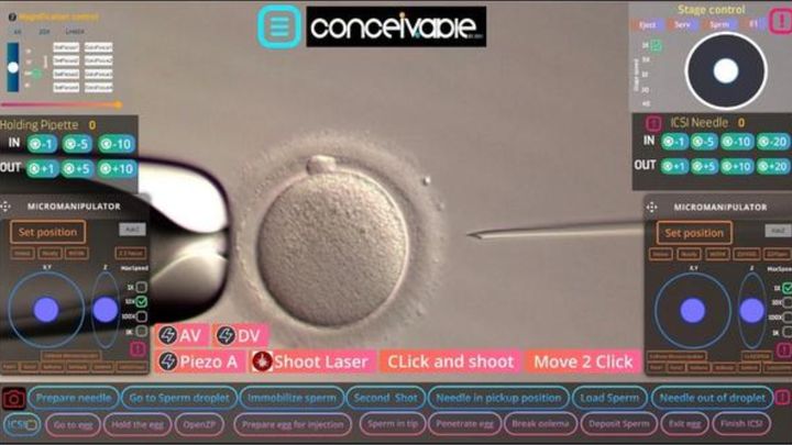 ほぼ完全にAI制御の機械による体外受精で生まれた世界初の赤ちゃん