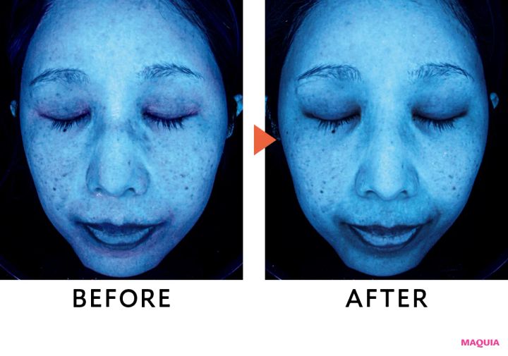 肌分析機がとらえた潜在シミの変化に驚き！ ポーラ、エリクシールほか新作UVのブライトニング効果を検証_14