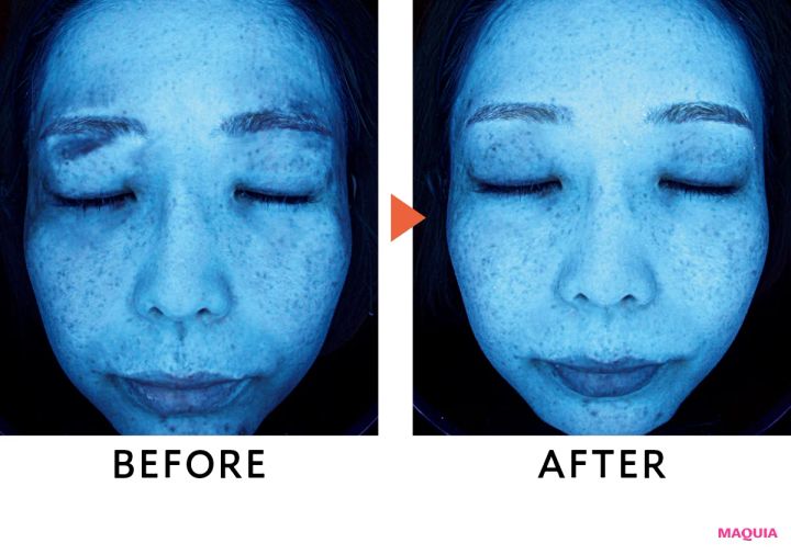 肌分析機がとらえた潜在シミの変化に驚き！ ポーラ、エリクシールほか新作UVのブライトニング効果を検証_5