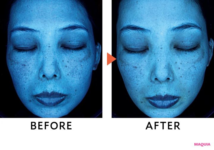 肌分析機がとらえた潜在シミの変化に驚き！ ポーラ、エリクシールほか新作UVのブライトニング効果を検証_8