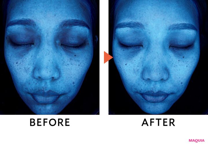 肌分析機がとらえた潜在シミの変化に驚き！ ポーラ、エリクシールほか新作UVのブライトニング効果を検証_11