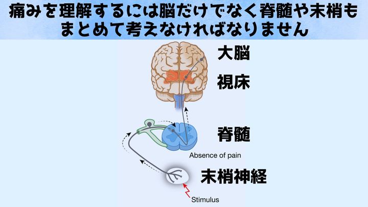 脳オルガノイドを「直列接続」 して痛覚を可視化することに成功