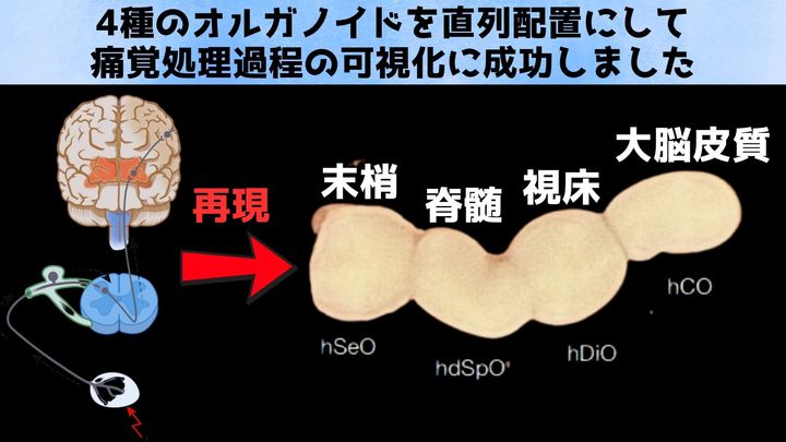 脳オルガノイドを「直列接続」 して痛覚を可視化することに成功