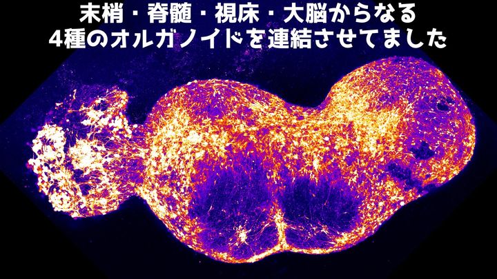四つのオルガノイドを“直列接続”──試験管で痛みの伝播を可視化