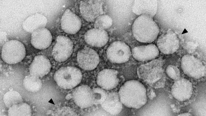 ある一般的なワクチンは認知症のリスクを20％も減らす効果があった【Nature】