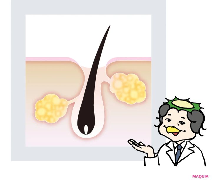 黒ずみ・開き・たるみ、あなたの毛穴に効く美容成分をレクチャー。毛穴タイプで効かせる成分は違う！_12