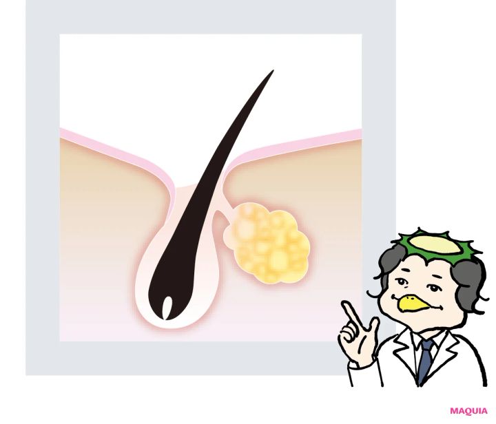 黒ずみ・開き・たるみ、あなたの毛穴に効く美容成分をレクチャー。毛穴タイプで効かせる成分は違う！_20