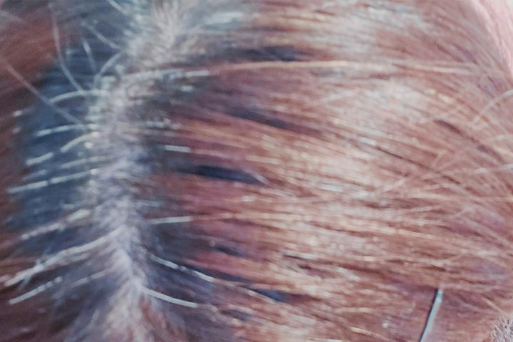 アラフォー、生え際白髪のイメージ