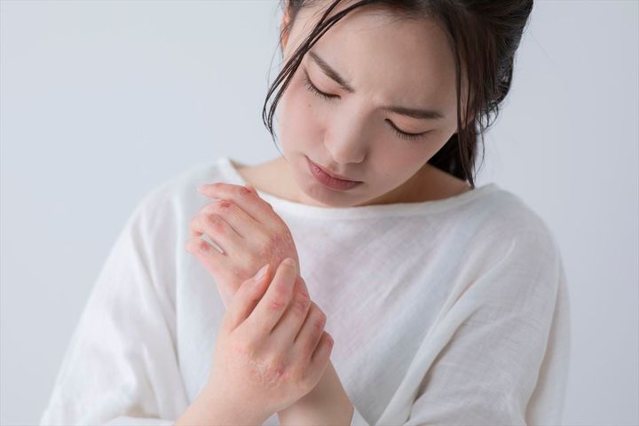 食物アレルギーに「遅延型」「即時型」があるの？