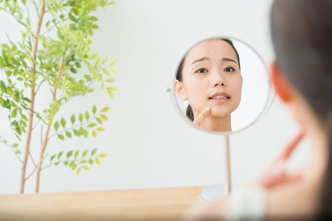 歯肉退縮が気になる女性