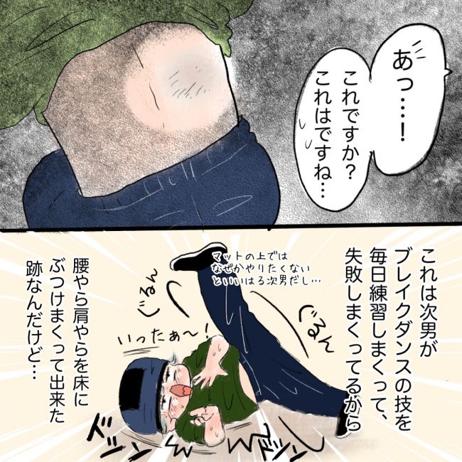 たんこぶホントに大丈夫？ 4