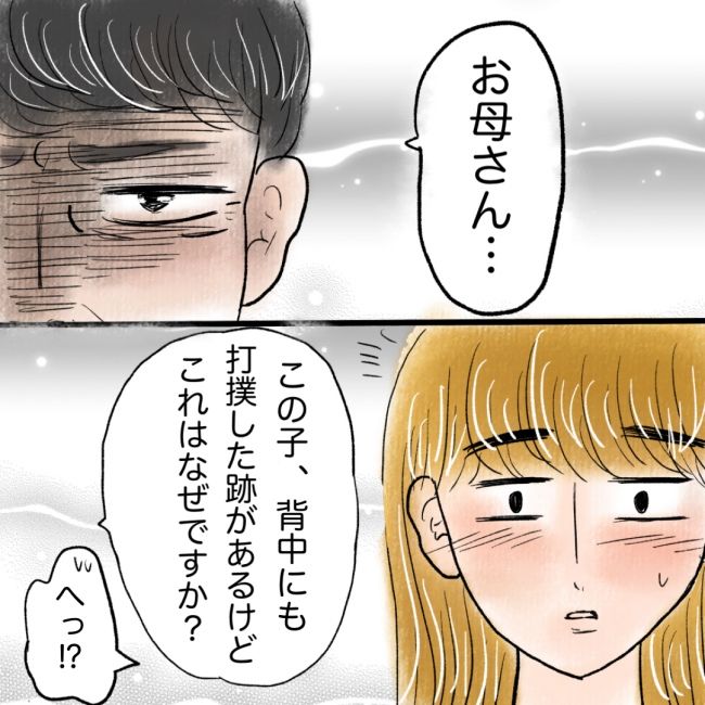 たんこぶホントに大丈夫？ 4