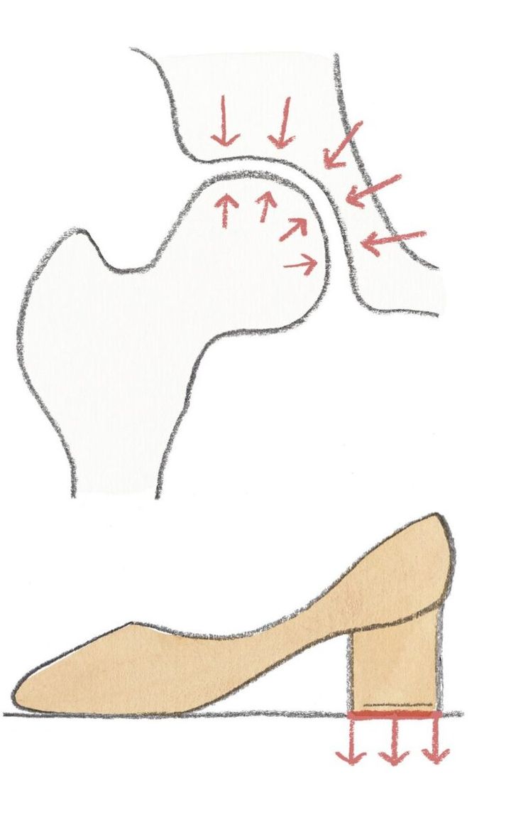 立っているときの骨頭のポジション