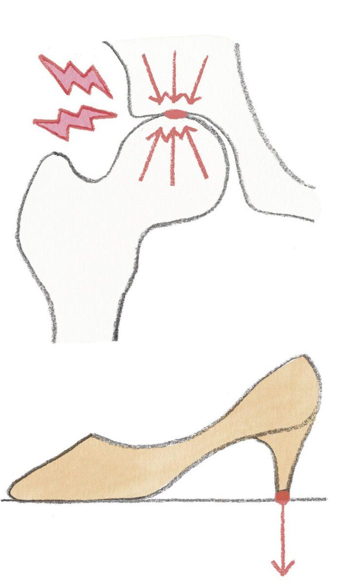 座っているときの骨頭のポジション