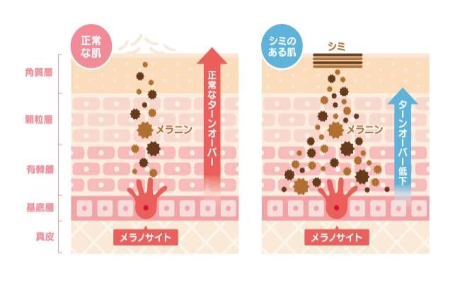 皮膚のターンオーバーのイメージイラスト