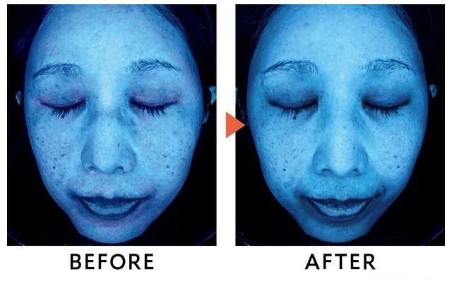 新作 ソフィーナiP 日焼け止め 03 シミができやすい肌環境 口コミ