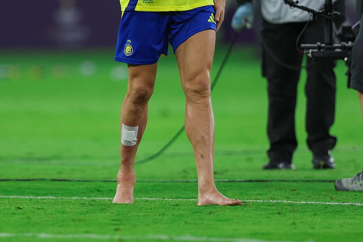 40歳ロナウド、J1最下位チームとの決戦で途中交代した理由を監督が説明「ケガではない」