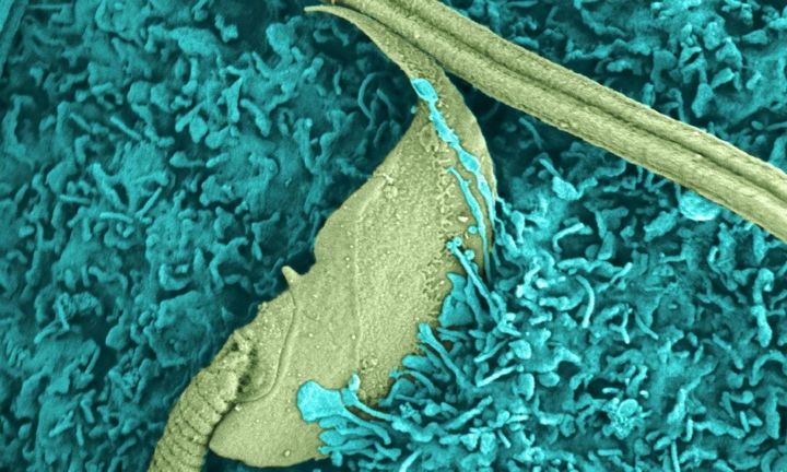 卵子は「捕食者」としての動きがある