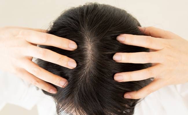 頭皮マッサージのイメージ