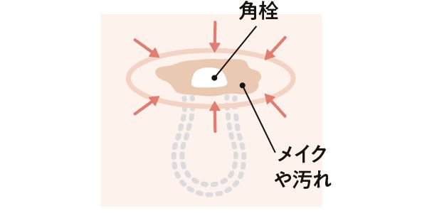 角栓 メイクや汚れ
