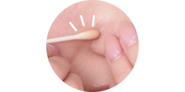 立体形状の鼻は、小さな綿棒で毛穴ひとつひとつに入れ込んで！
