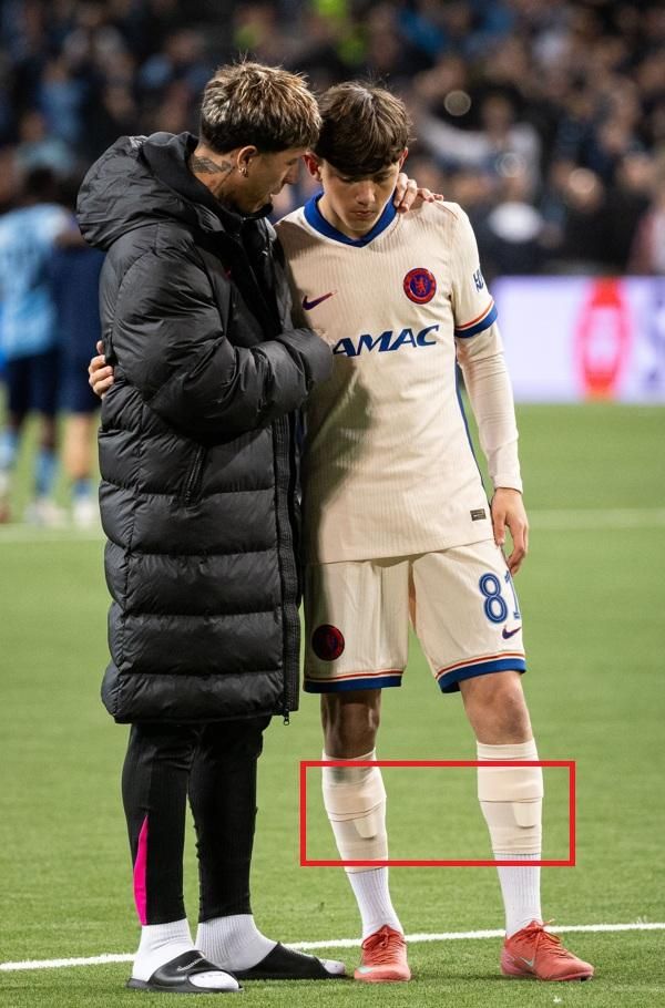 16歳でデビューした神童スター、すね当てがヤバいと話題