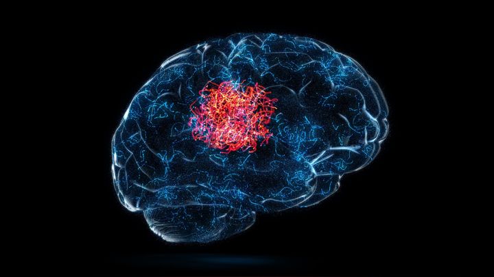 “無”が語る意識：静寂もまた脳の声