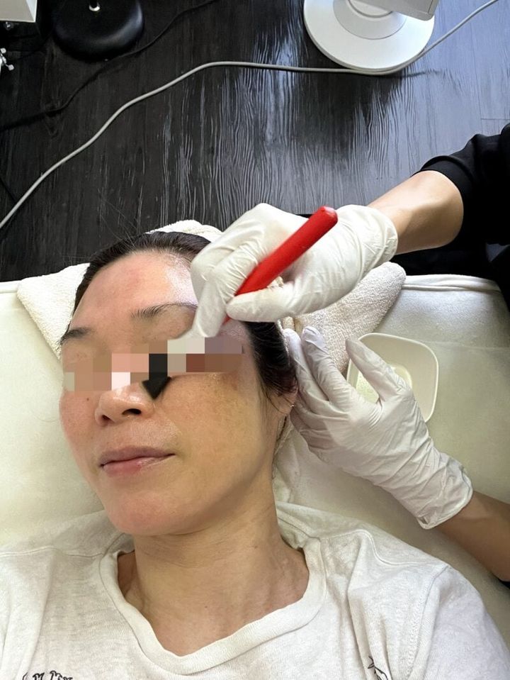 絶賛ピーリング中