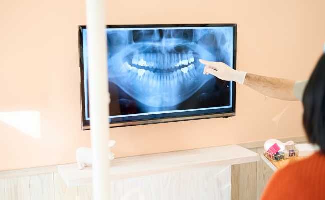 口元のレントゲンを見る女性と医師のイメージ